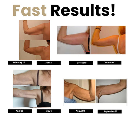 Celuvive 3D Sculpting Sleeves - No more flabby arms